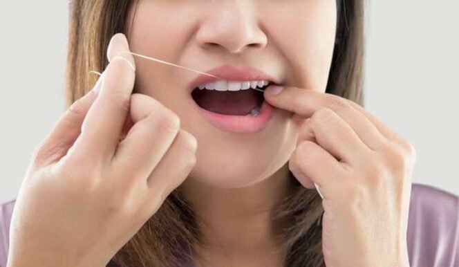 
Ilustrasi: Cara Menghilangkan Karang Gigi. (Dok: Istimewa)
