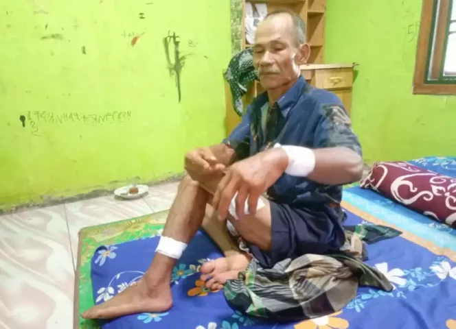 
Jaran (60) Korban Pembegalan di Tamansari, Setu, Jalani Perawatan Luka Sajam. (Dok: Istimewa)