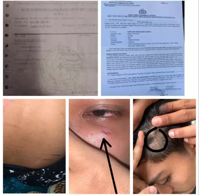 
Remaja di Tambun Selatan Diduga Dikeroyok, Keluarga Tempuh Jalur Hukum